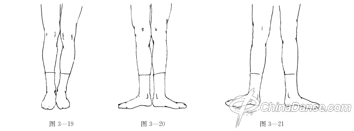 【教師課堂】兒童舞蹈教學(xué) 腳位的規(guī)范